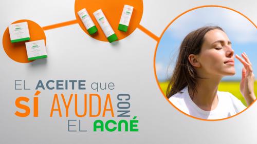 La rutina de skincare más efectiva para eliminar el acné: ¡CON ACEITE!                                                                                                                                  