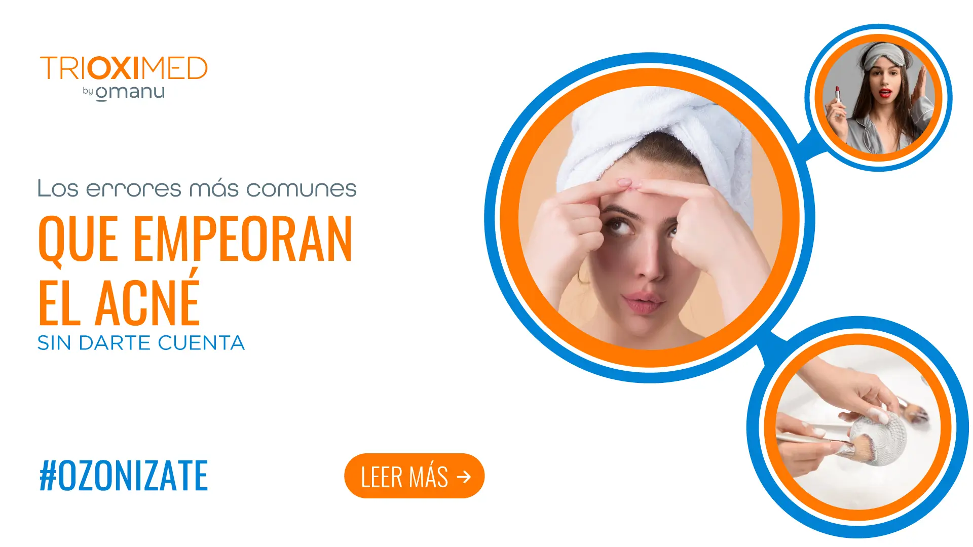 Mujer exprimiendo un grano en la frente, ejemplo de errores que empeoran el acné