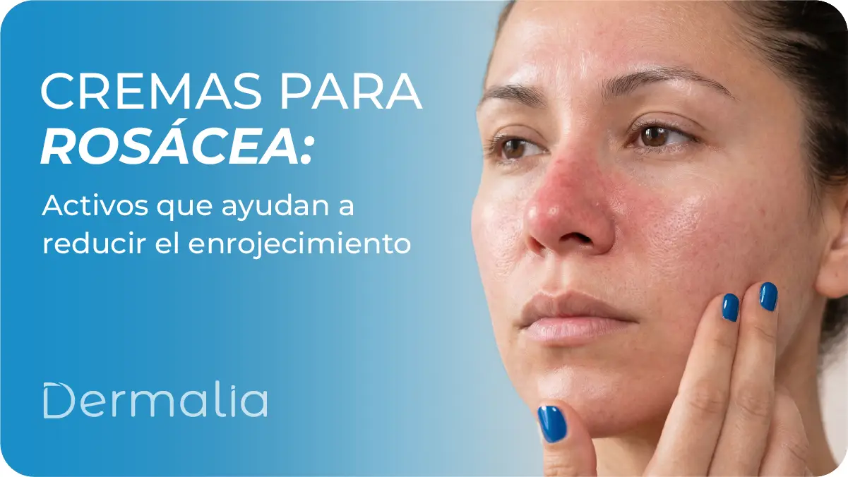 Mujer con rosácea y enrojecimiento facial mostrando irritación en la piel del rostro