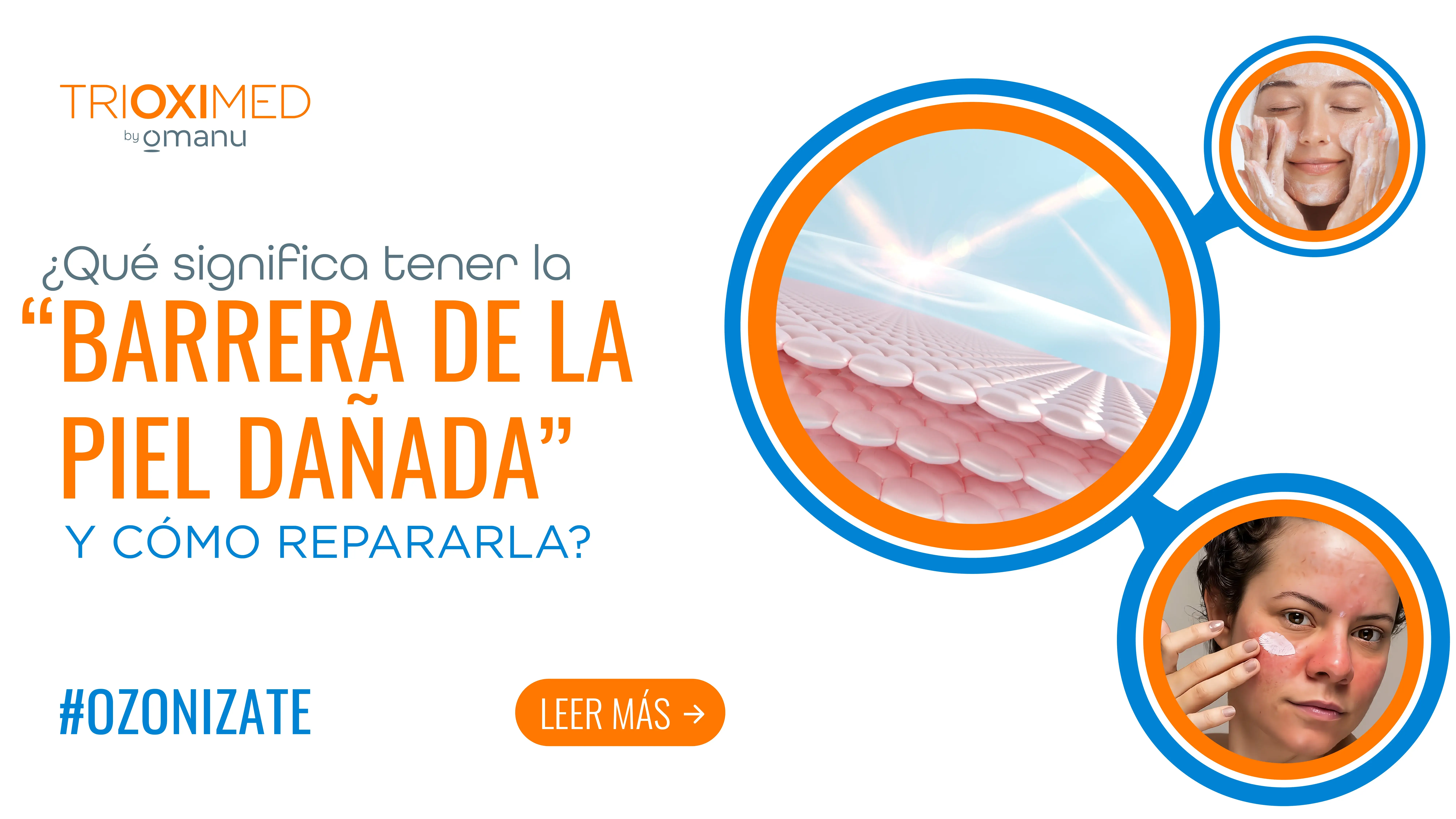 Barrera de la piel dañada con enrojecimiento facial y explicación visual del manto hidrolipídico y su reparación