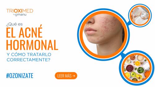 Mujer con acné hormonal en el rostro, mostrando brotes en la piel, con elementos visuales sobre tratamiento, hormonas y alimentación saludable.