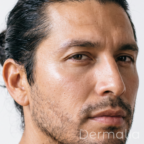 Hidratación facial con ácido hialurónico. Hombre con piel facial hidratada y textura uniforme.
