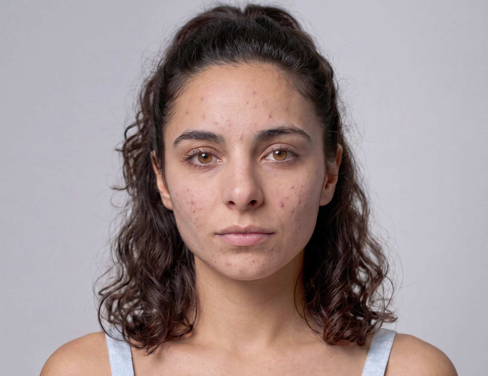 Después